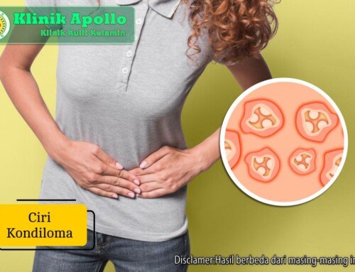 Jangan Abaikan! Ini Ciri Kondiloma yang Bisa Memicu Komplikasi