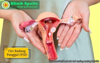 Ilustrasi Ciri Radang Panggul.