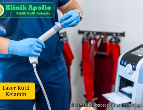Laser Kutil Kelamin: Pilihan Tepat untuk Hindari Risiko Kambuh