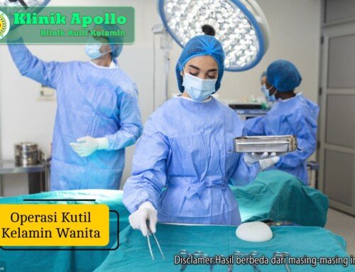 Operasi Kutil Kelamin Wanita: Tahapan, Biaya & Waktu Pemulihan