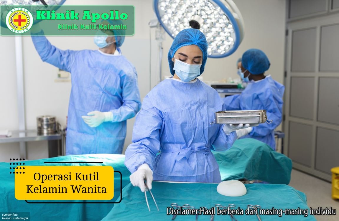 Ilustrasi Operasi Kutil Kelamin Wanita.