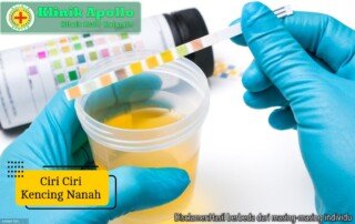 Ilustrasi Ciri Ciri Kencing Nanah.