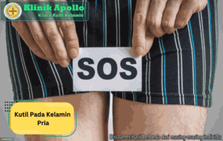 Ilustrasi Kutil pada Kelamin Pria.