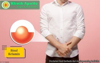 Ilustrasi Bisul Kelamin.