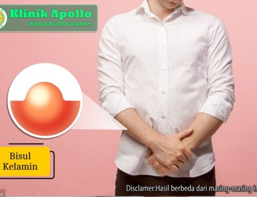 Bisul Kelamin Membesar dan Nyeri? Ketahui Cara Mengatasinya