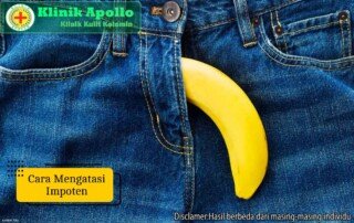 Ilustrasi Cara Mengatasi Impoten.