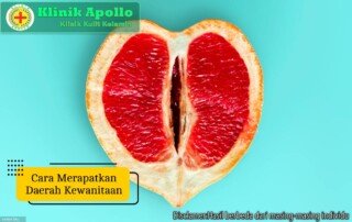 Ilustrasi Cara Merapatkan Daerah Kewanitaan.