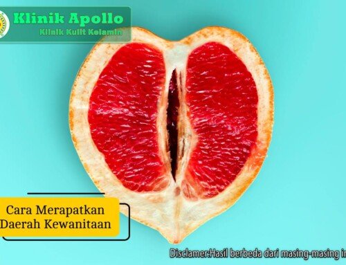 Cara Merapatkan Daerah Kewanitaan dengan Metode yang Tepat