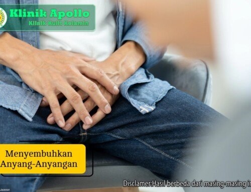 Menyembuhkan Anyang-anyangan Disertai Nyeri, Apa Solusinya?