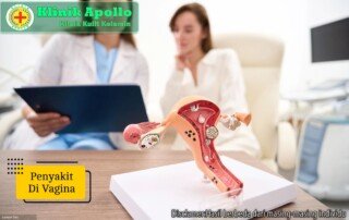 Ilustrasi Penyakit di Vagina.