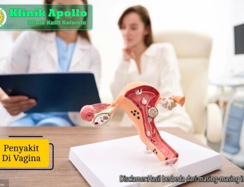 Jangan Diabaikan! Penyakit di Vagina Bisa Sebabkan Komplikasi