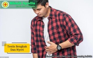 Ilustrasi Testis Bengkak dan Nyeri.