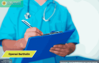 Ilustrasi Operasi Bartholin.