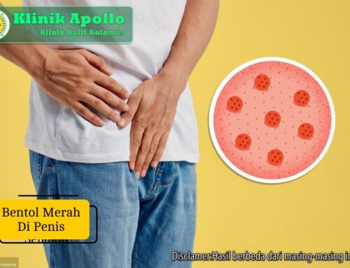 Bentol Merah di Penis Disertai Gatal, Apa Penyebabnya?