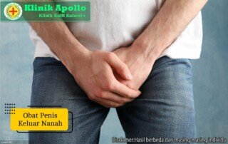 Ilustrasi Obat Penis keluar Nanah.