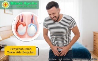 Ilustrasi Penyebab Buah Zakar Ada Benjolan.