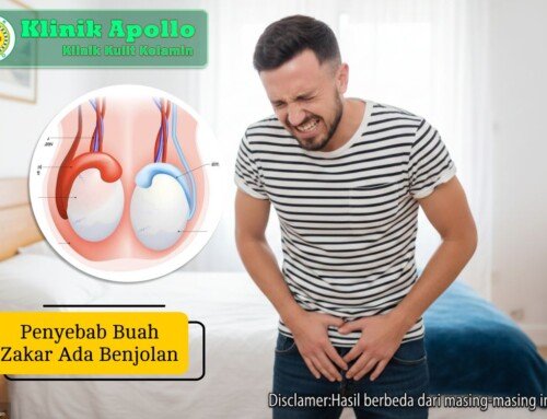 Waspada! Penyebab Buah Zakar Ada Benjolan Sering Diabaikan