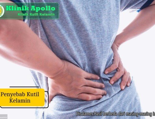 Kenali Penyebab Kutil Kelamin Sejak Dini Agar Tidak Menyebar