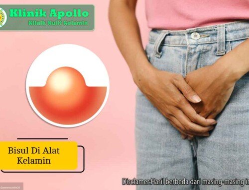 Penyebab Bisul di Alat Kelamin dan Cara Tepat Mengobatinya