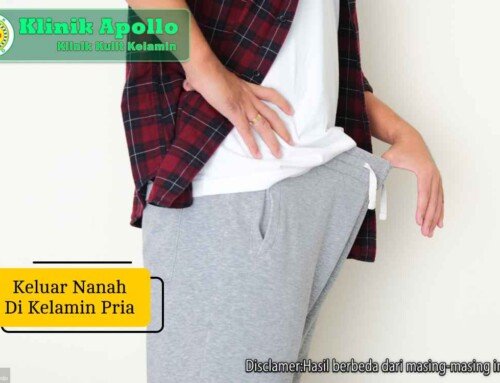 Waspada! Keluar Nanah di Kelamin Pria Bisa Memicu Komplikasi