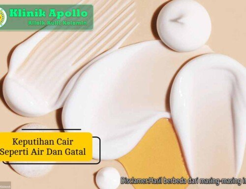 Keputihan Cair Seperti Air dan Gatal, Apakah Berbahaya?