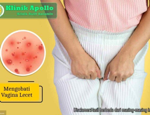 Jangan Sepelekan! Ini Cara Mengobati Vagina Lecet dengan Benar