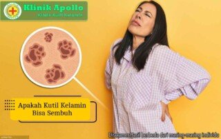 Ilustrasi Apakah Kutil Kelamin Bisa Sembuh.