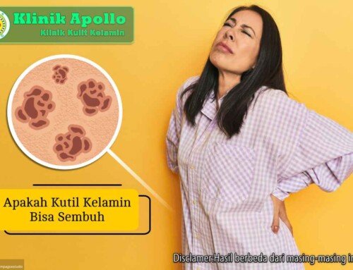 7 Fakta Penting tentang Kutil Kelamin: Apakah Bisa Sembuh Total?