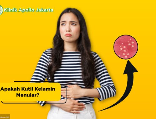 Apakah Kutil Kelamin Menular? Kenali Penularan & Mencegahnya