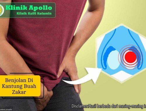 Jangan Abai Benjolan di Kantung Buah Zakar, Ini Fakta Medisnya