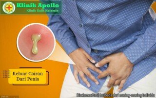 Ilustrasi Keluar Cairan dari Penis.