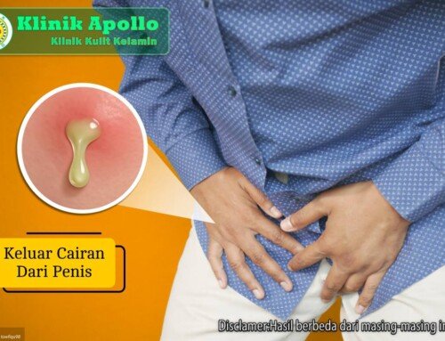 Keluar Cairan dari Penis: Gejala, Bahaya, dan Cara Mengatasi