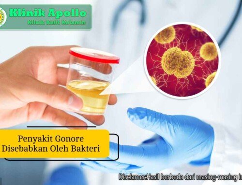 Penyakit Gonore Disebabkan Oleh Bakteri: Penularan & Cegah