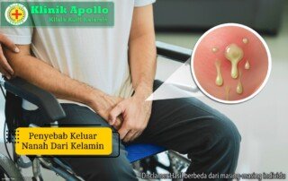 Ilustrasi Penyebab Keluar Nanah dari Kelamin.