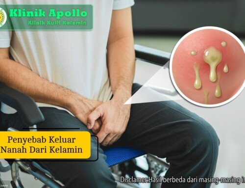 Penyebab Keluar Nanah dari Kelamin dan Cara Mengatasi