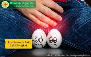 Ilustrasi Alat Kelamin Laki Laki Bengkak.