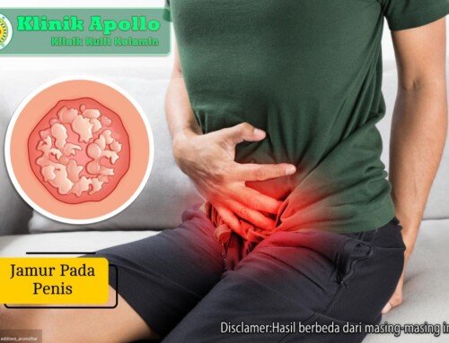 Jamur pada Penis: Penyebab, Gejala, dan Cara Mengobati
