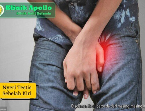 Nyeri Testis Sebelah Kiri: Penyebab yang Perlu Diwaspadai