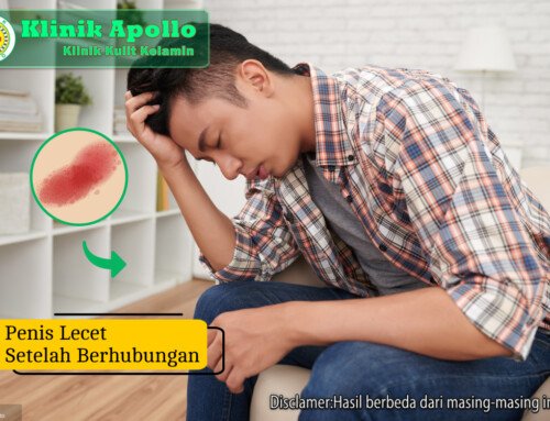 Penis Lecet Setelah Berhubungan: Penyebab & Cara Atasi
