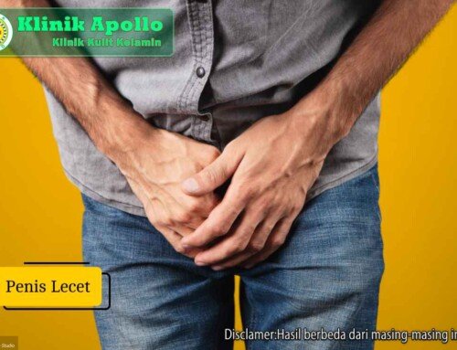 Penis Lecet: Penyebab, Cara Mengatasi, dan Tandanya