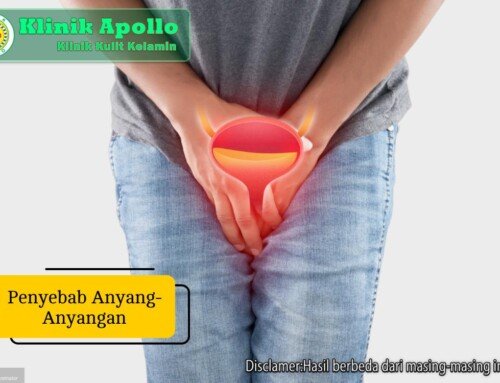 7 Penyebab Anyang-anyangan yang Sering Terjadi