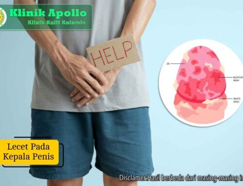 Lecet pada Kepala Penis? Kenali Penyebab dan Cara Mengobati