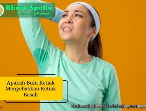 Apakah Bulu Ketiak Menyebabkan Ketiak Basah? Cek Faktanya