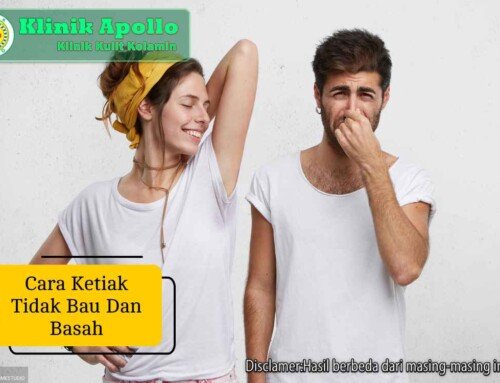 Cara Ketiak Tidak Bau dan Basah, Simak Tipsnya