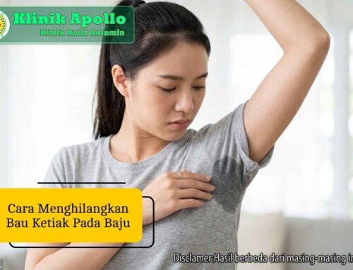 Cara Menghilangkan Bau Ketiak pada Baju Paling Ampuh