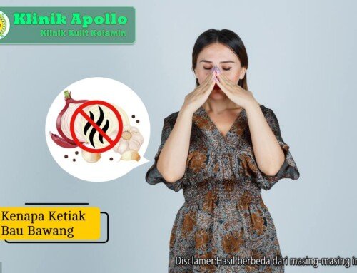 Kenapa Ketiak Bau Bawang? Kenali Penyebab dan Solusinya