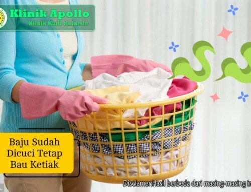 Baju Sudah Dicuci Tetap Bau Ketiak? Ini 7 Cara Mengatasinya