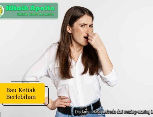 Bau Ketiak Berlebihan: Penyebab, Cara Mengatasi & Pencegahan