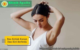 Ilustrasi Bau Ketiak Kanan dan Kiri Berbeda.