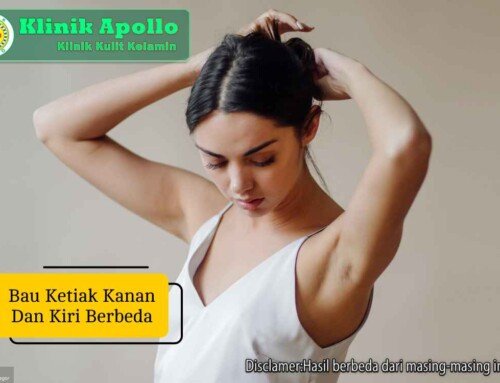 Kenapa Bau Ketiak Kanan dan Kiri Berbeda? Ini Penyebabnya